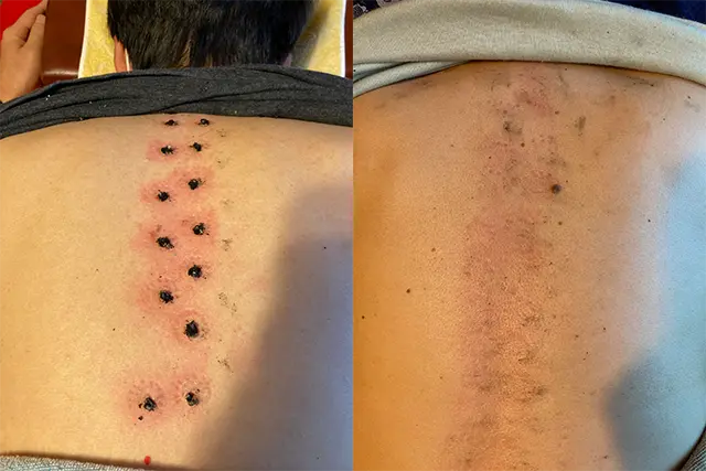 トップページ症例